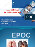 Epoc