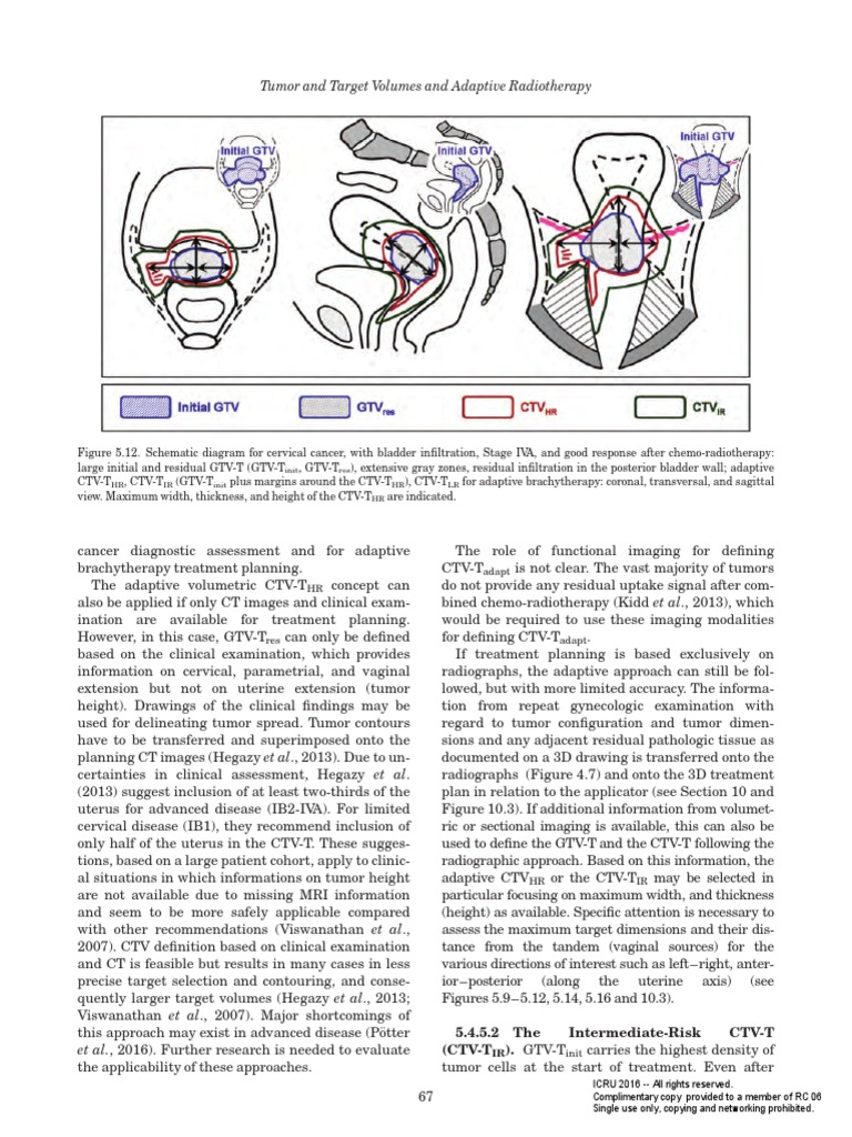 Adaptive Brachytherapy for Cervical Cancer | PDF | Radiation Therapy ...