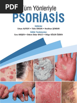 Psoriasis Kitap Kucuk PDF 