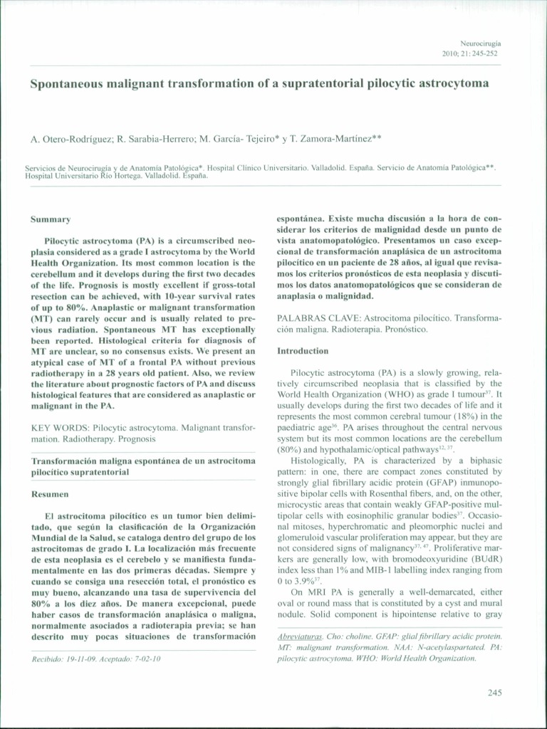 Astrocitoma Pilocítico PDF Radiation Therapy Neoplasms
