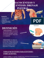 Toraconcentesis para Centesis 28 (1) - 1