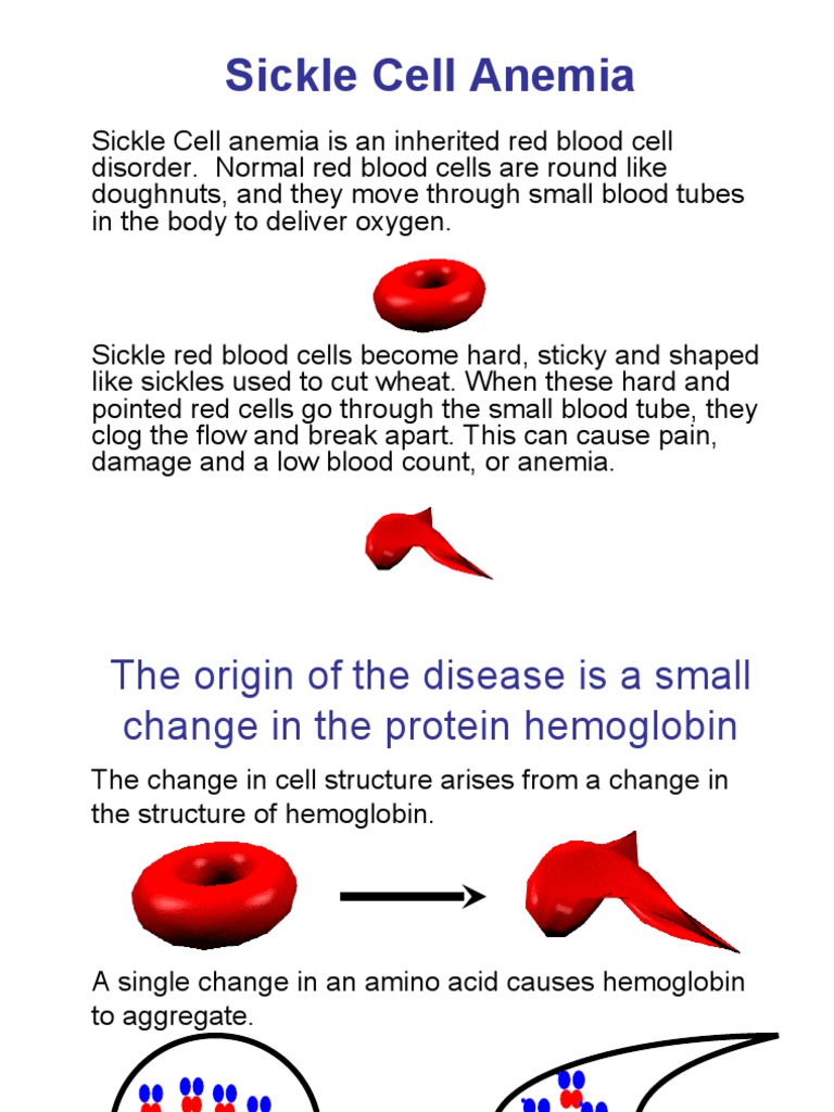 Sickle Cell Anemia | PDF | Hemoglobin | Blood