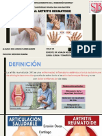 Artritis Reumatoide