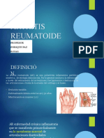 Artritisreumatoide Junio UPSJB