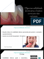 AULA 3 - Hipersensibilidade DentinÃ¡Ria e LCNC