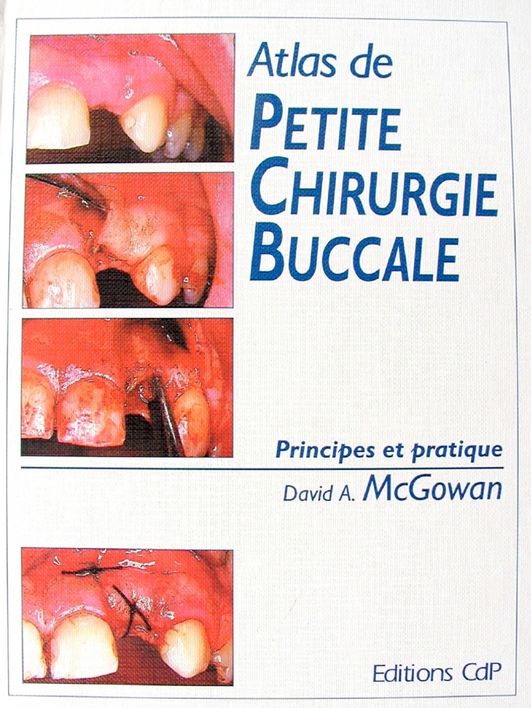Atlas de Petite Chirurgie Buccale (1) PDF