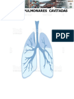 Lesiones Cavitadas Aereas Pulmonares r2