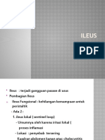 Ileus PP