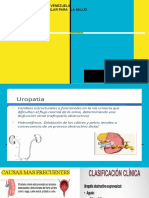 Uropatia Ostructiva