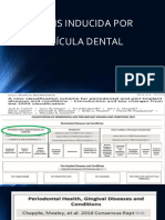 Gingivitis Inducida Por Biopelicula Dental Con Periodontograma 2023