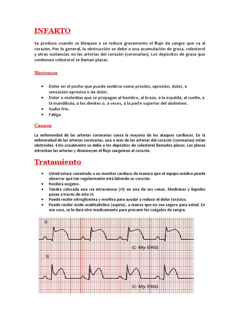 INFARTO | Descargar gratis PDF | Enfermedades y trastornos humanos ...