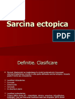 Sarcina ectopica