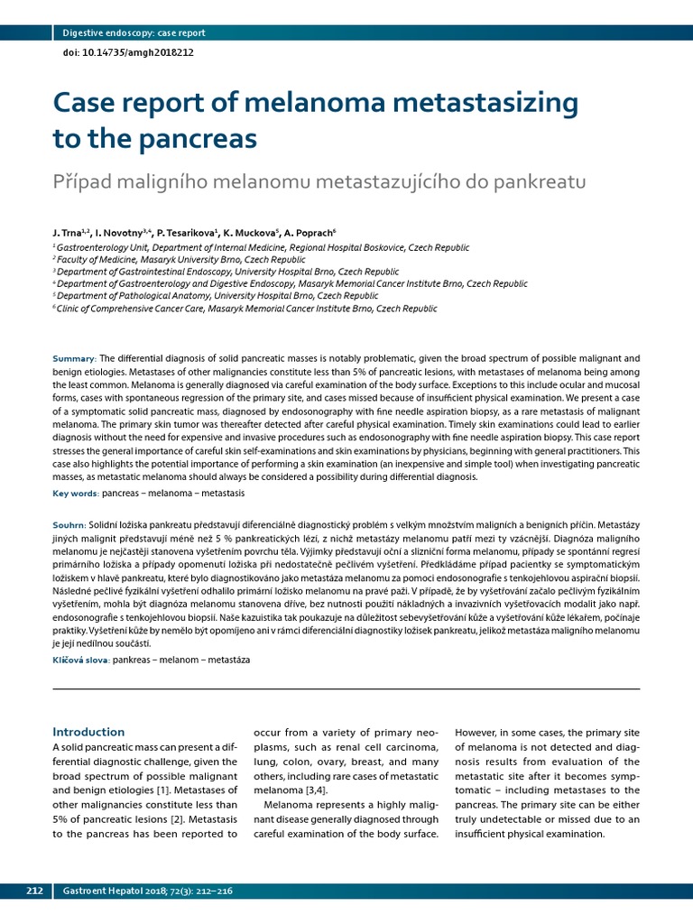 Melanoma PDF Metastasis Pancreatic Cancer