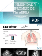 13 Autoinmunidad y Compromiso de Via Aerea