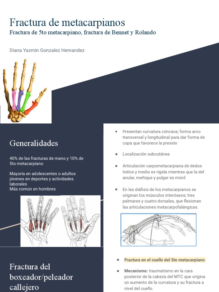 Fracturas de Metacarpianos: Clasificación y Tratamiento | PDF | Mano