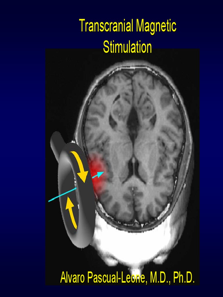 Introduction To TMS - Harvard Intensive Course | PDF | Cerebral Cortex ...