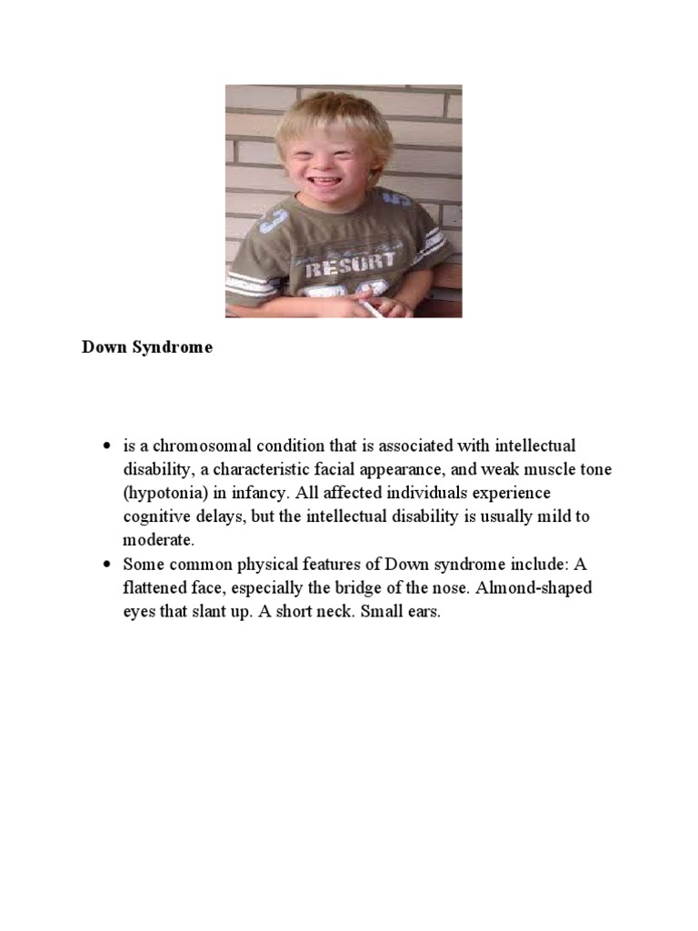 Shih Tzu And Down Syndrome A Comprehensive Overview - xqqe20h