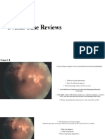 Uveitis Case Reviews