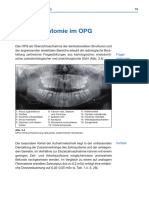 3 Roentgenanatomie Im OPG Spitta Digitale Radiologie