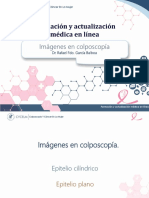 2.colposcopía y Cáncer en La Mujer