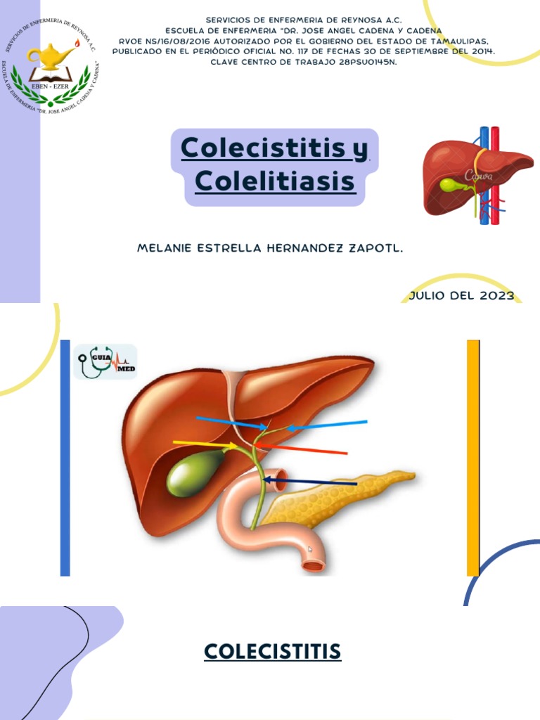 Colecistitis y Colelitiasis | PDF | Bilis | Vesícula biliar