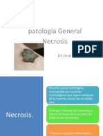 Necrosis+2021dr Aguayo
