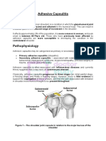 Adhesive Capsulitis