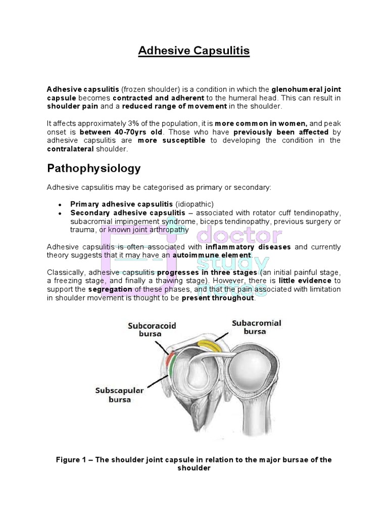 Adhesive Capsulitis PDF