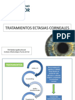 Tratamientos para Ectasias Corneales