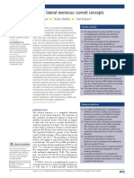 Discoid Lateral Meniscus