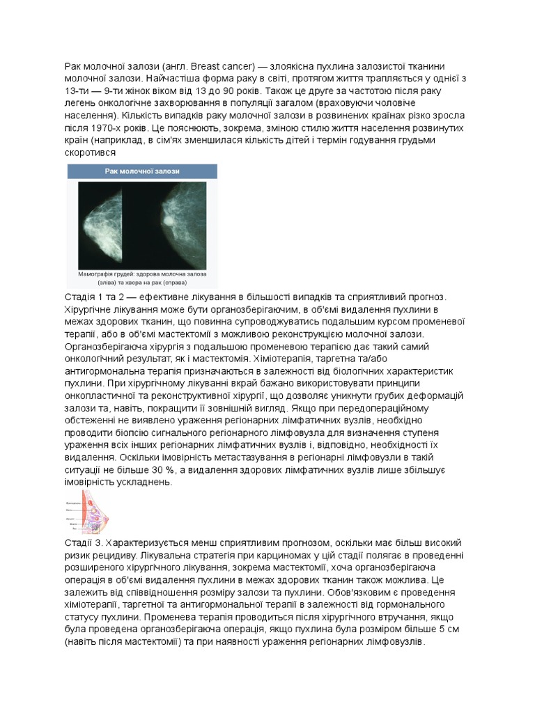 Рак молочної залози | PDF