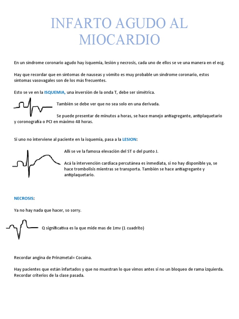 Infarto Agudo Al Miocardio | PDF | Electrocardiografia | Infarto de ...