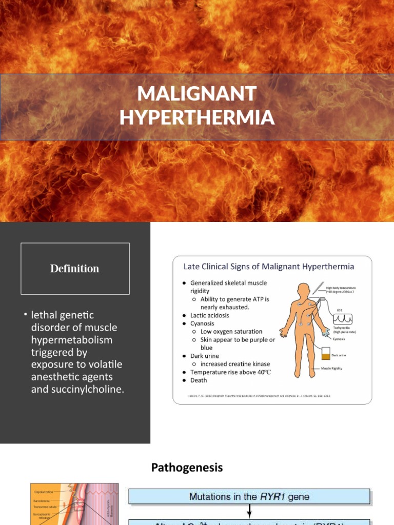 Malignant Hyperthermia Overview and Management | PDF