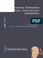 Otoesclerosis, Schwanoma Vestibular, Tumor Del Saco