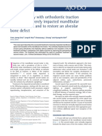 Rescue Therapy With Orthodontic Traction To Manage Severely Impacted Mandibular Second Molars and To Restore An Alveolar Bone Defect