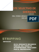 Definición y técnica del stripping dental