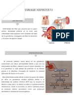 Sindrome NEFROTICO