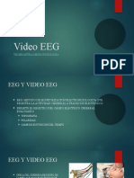 Video EEG