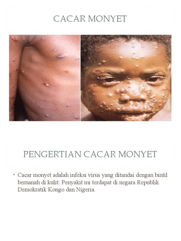 Cacar Mnyt | PDF | Sains & Matematika