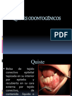 Quistesodontognicos 140619093531 Phpapp02