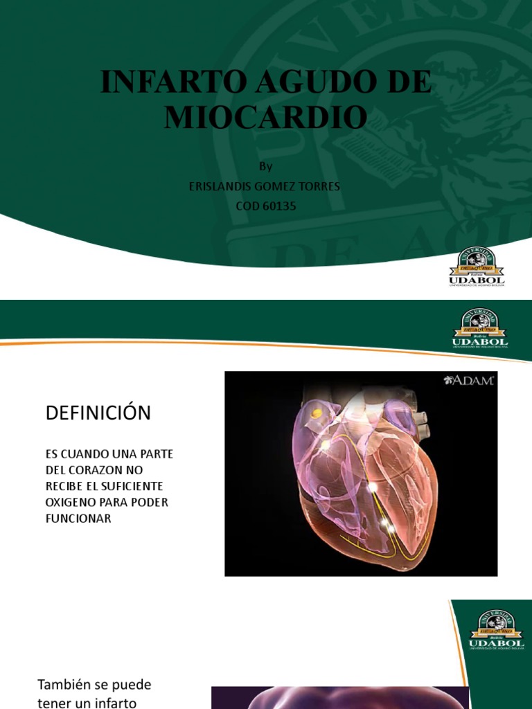 Infarto Agudo de Miocardio: Causas y Tratamiento | PDF