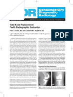 Total Knee Replacement Part I: Radiographic Evaluation: Felix S. Chew, MD, and Catherine C. Roberts, MD