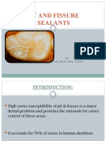 Pit and Fissure Sealant