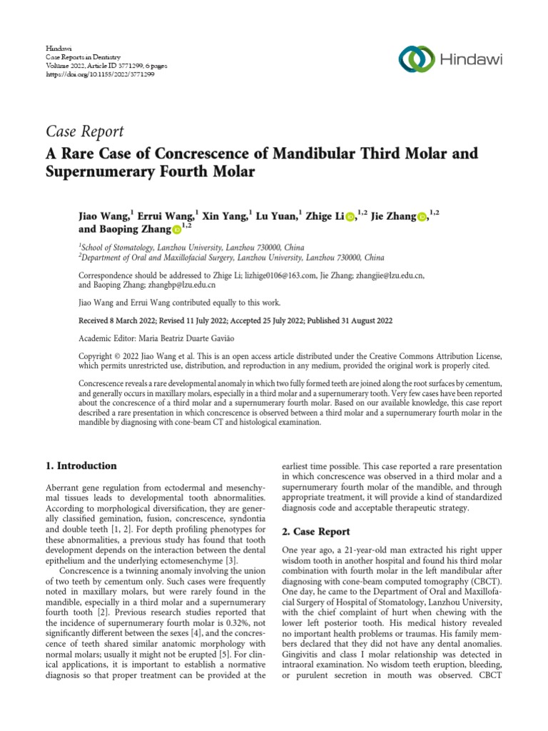 case-report-a-rare-case-of-concrescence-of-mandibular-third-molar-and