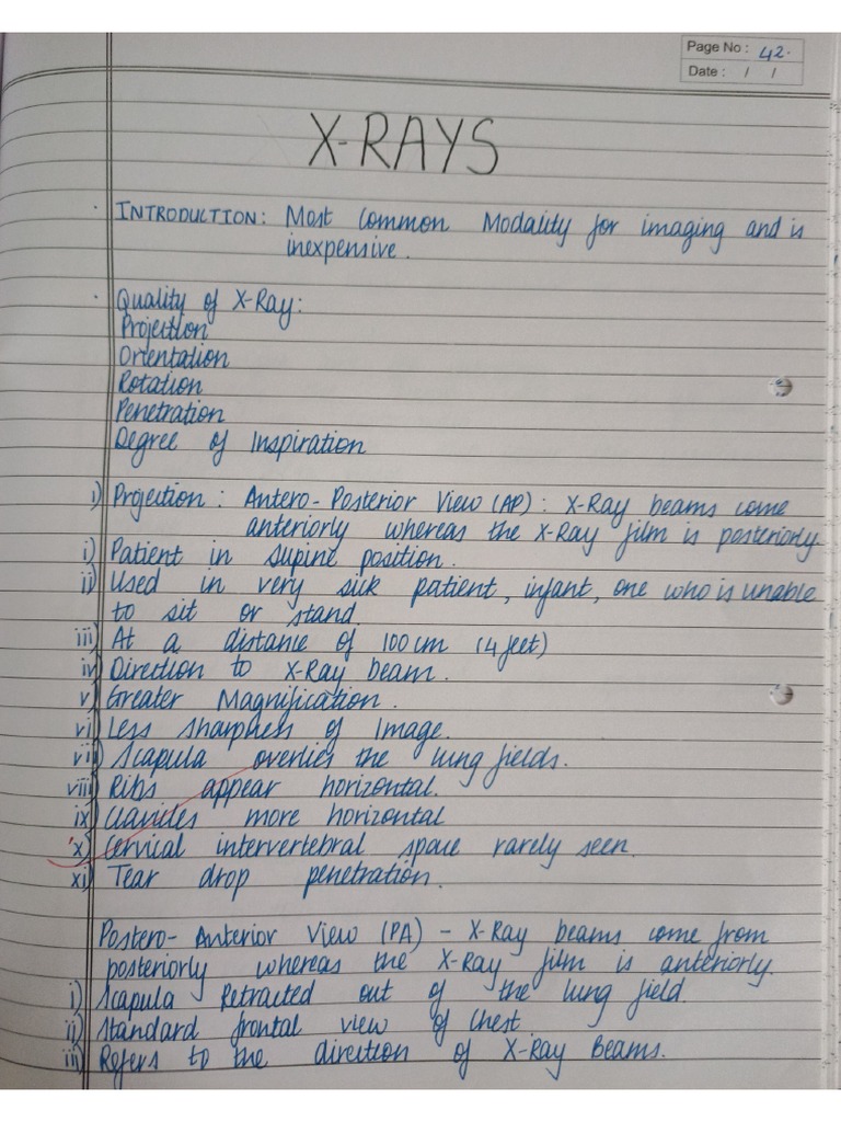 CHEST XRAY journal work PDF
