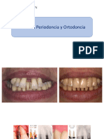Periodoncia - Ortodoncia