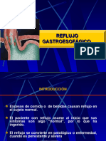 Reflujo Gastroesofagico