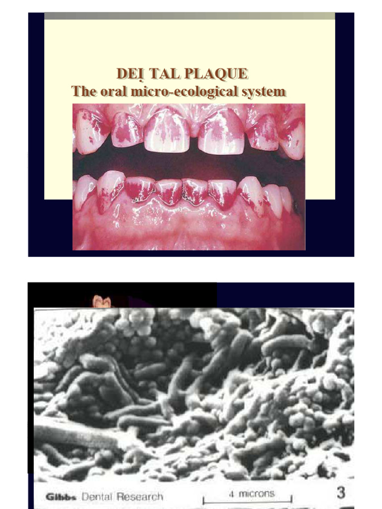 Understanding Dental Plaque Formation | PDF | Periodontology | Tooth Enamel