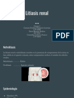 Litiasis Renal