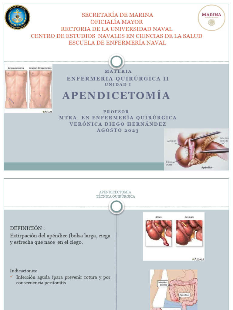 Técnica Quirúrgica de Apendicectomía | PDF | Especialidades Quirúrgicas ...